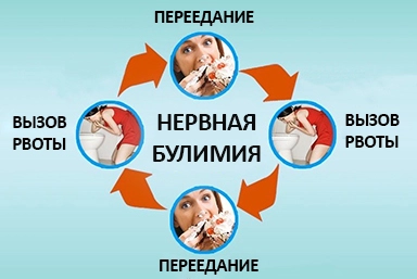Лечение булимии в Михайловке